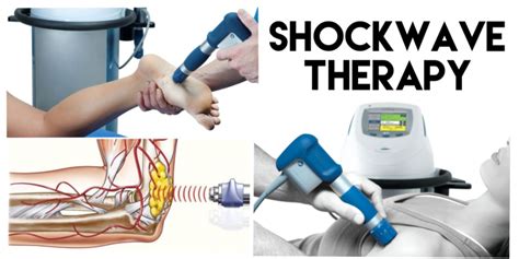 shockwave bagshot|Bagshot: 10 expert Orthopaedic surgeons for shockwave therapy .